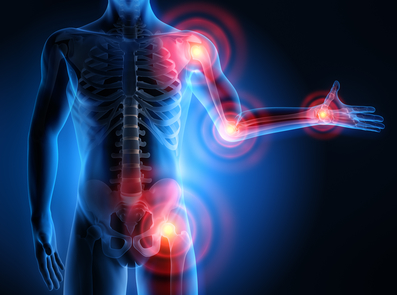 Slides Αρθρίτιδας